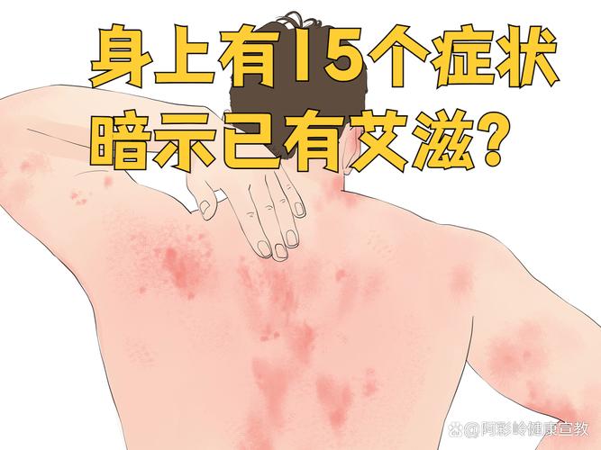 艾滋病患者转院遭拒？真相、应对及患者自述经历全在这